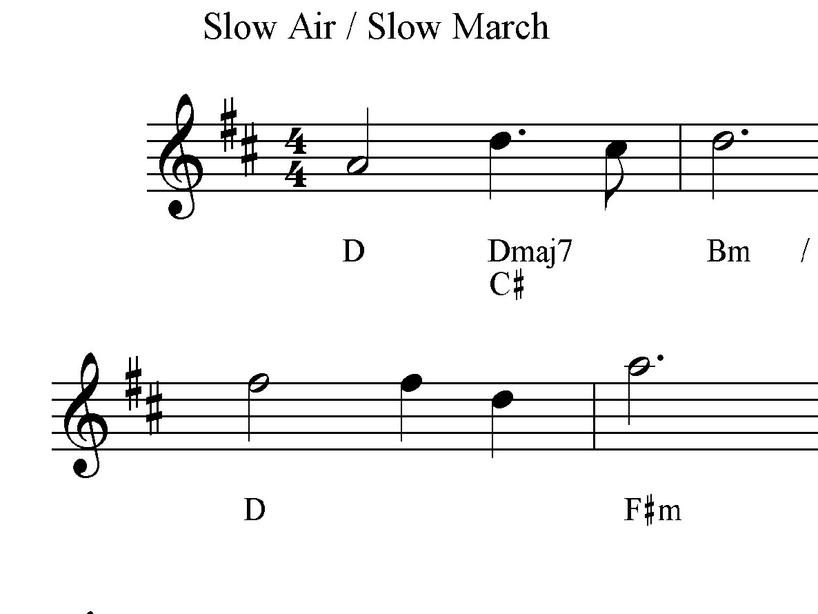 The Angels Of Dunblane